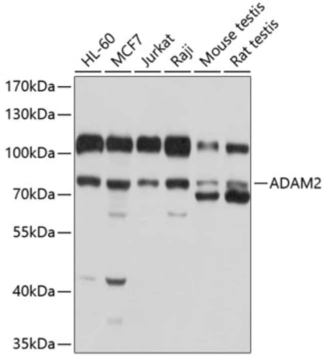 100UL ADAM2 ANTIBODY 100 ul