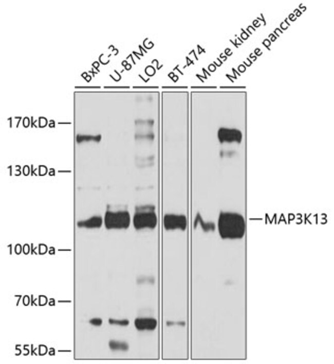 100UL LZK ANTIBODY 100 ul