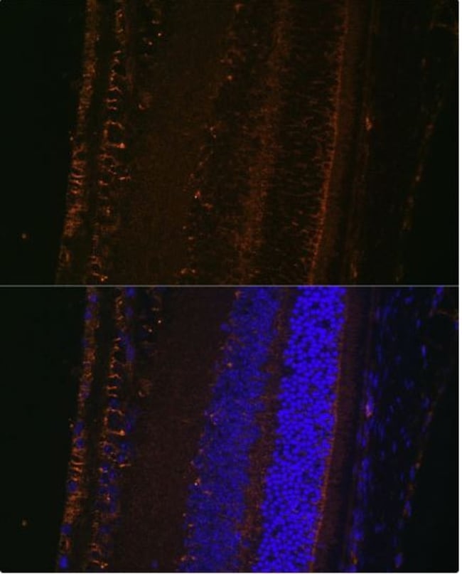 100UL LOXL1 ANTIBODY 100 ul