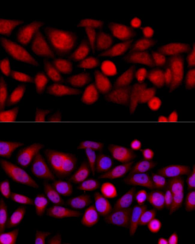 100UL KIF4A ANTIBODY 100 ul