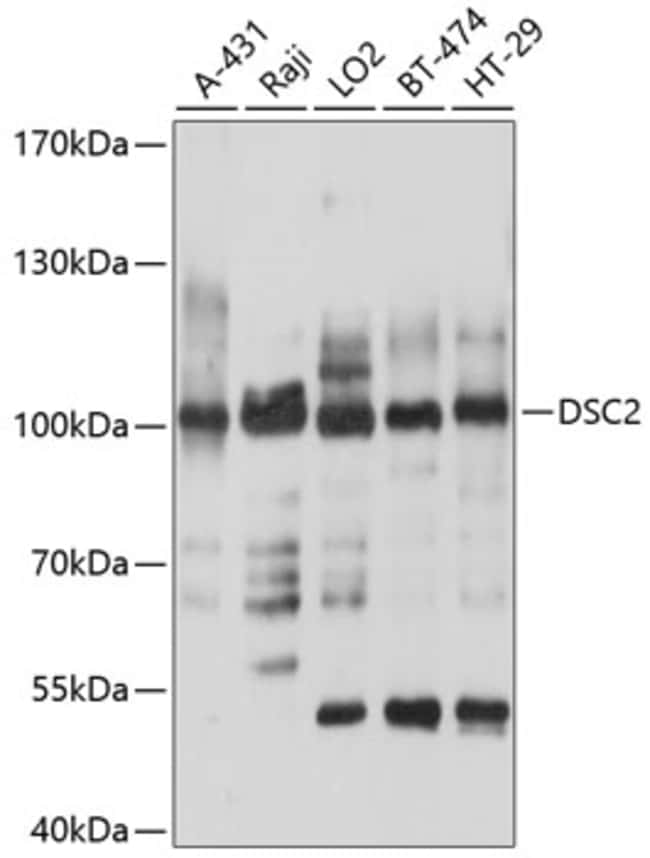 100UL DESMOCOLLIN 2 ANTIBODY 100 ul
