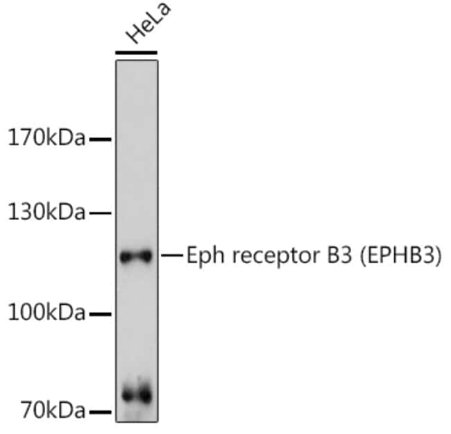 100UL EPHB3 ANTIBODY 100 ul