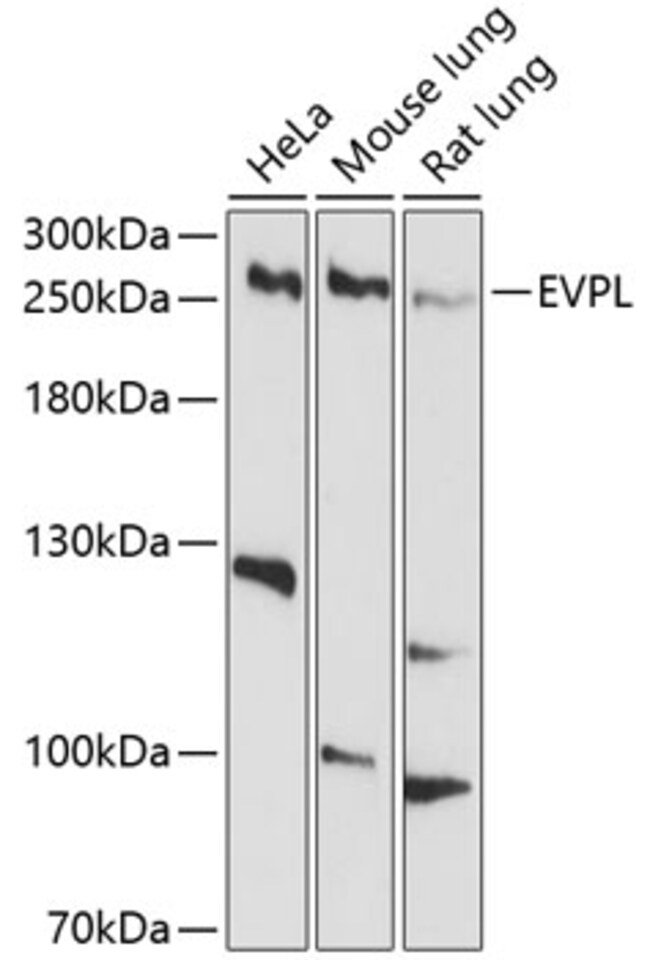 100UL EVPL ANTIBODY 100 ul