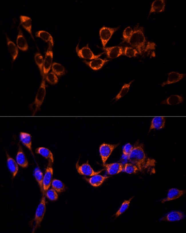 100UL GPR30 ANTIBODY 100 ul