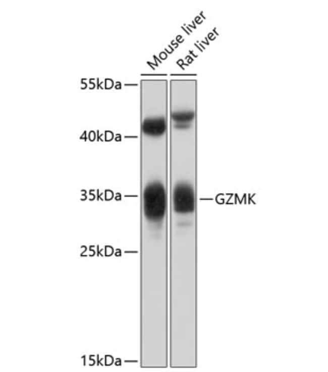 100UL GRANZYME K ANTIBODY 100 ul