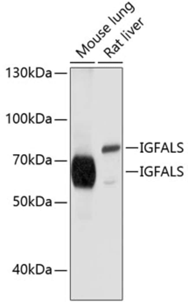 100UL ALS ANTIBODY 100 ul