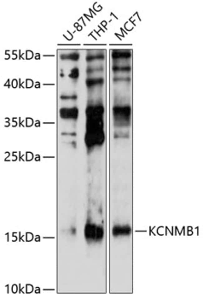 100UL KCNMB1 ANTIBODY 100 ul
