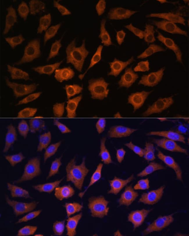 100UL 14-3-3 BETA ANTIBODY 100 ul