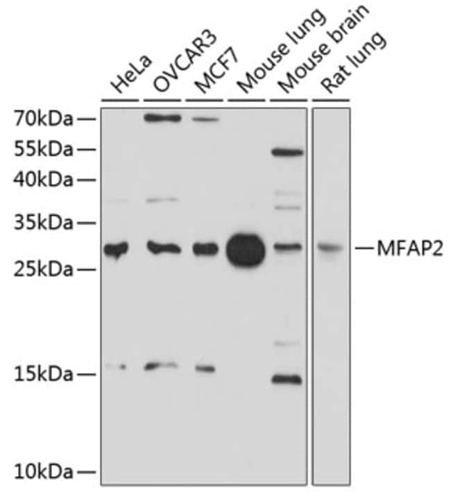100UL MFAP2 ANTIBODY 100 ul