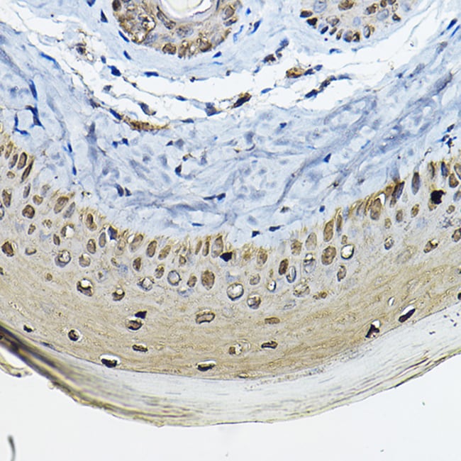100UL 14-3-3 SIGMA ANTIBODY 100 ul