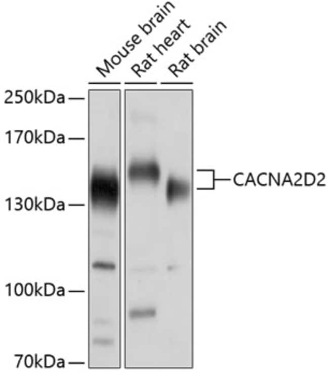 100UL CACNA2D2 ANTIBODY 100 ul