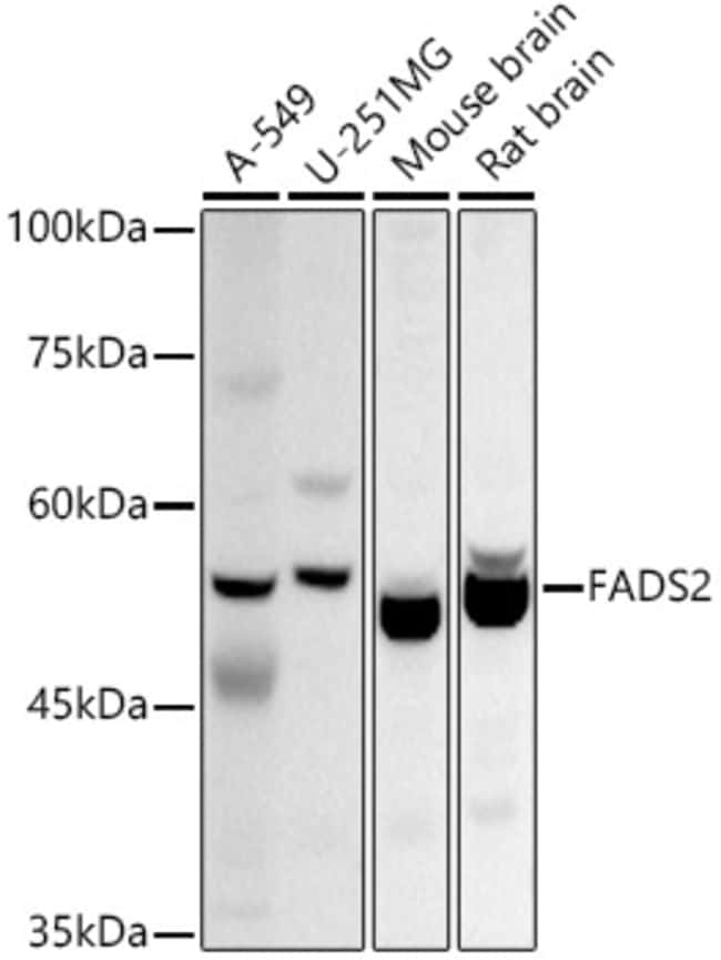 100UL FADS2 ANTIBODY 100 ul
