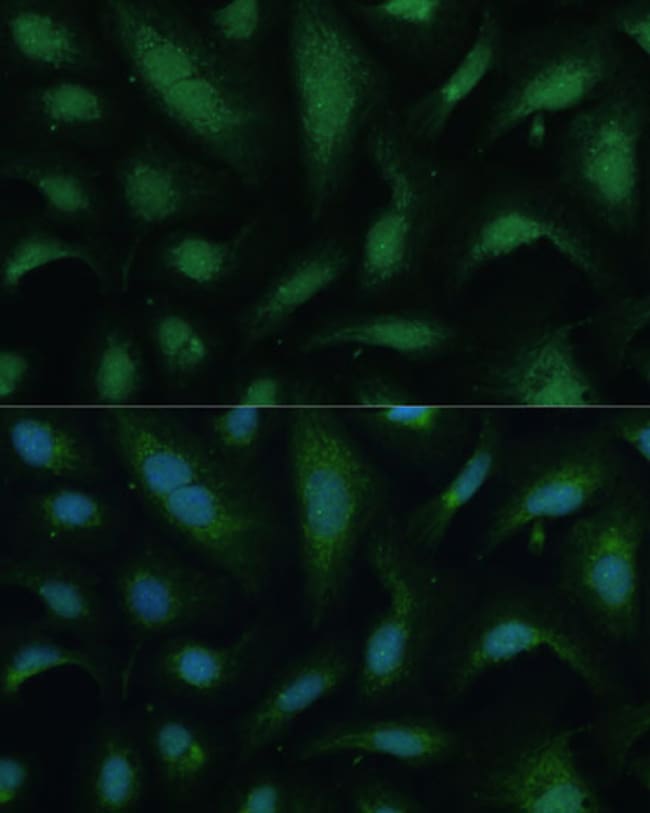 100UL KIF14 ANTIBODY 100 ul