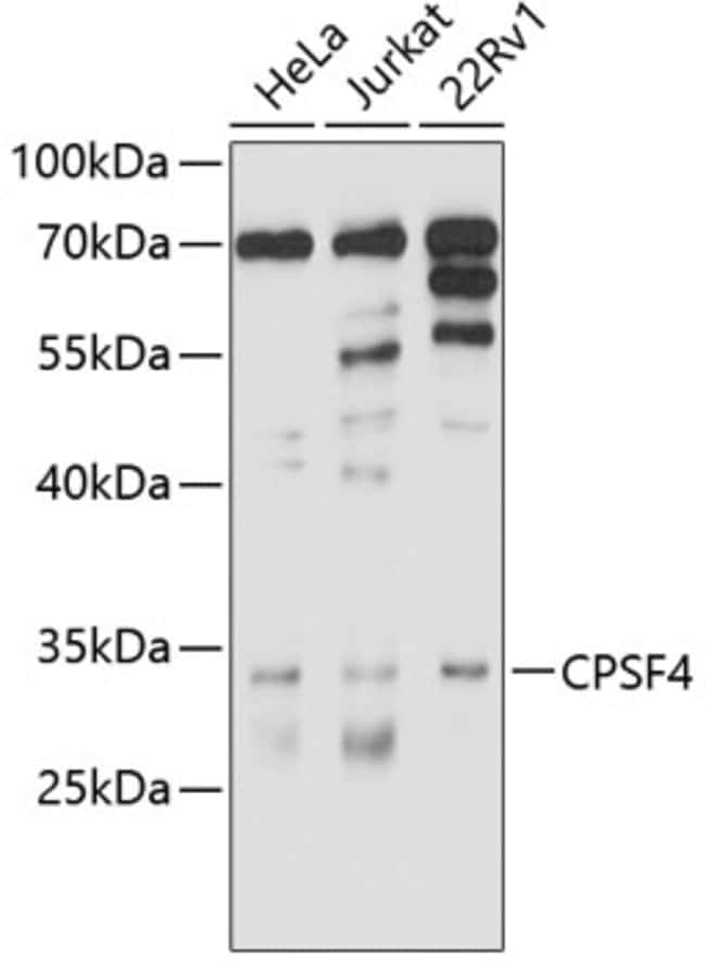 100UL CPSF4 ANTIBODY 100 ul