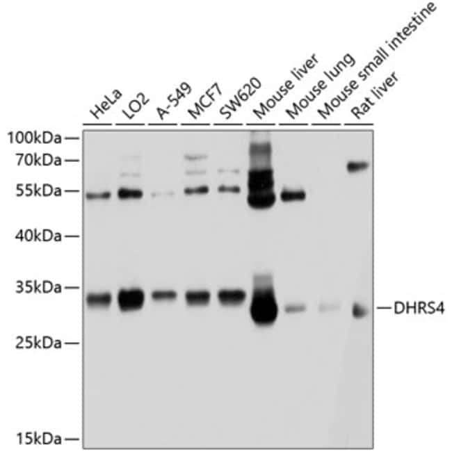100UL DHRS4 ANTIBODY 100 ul