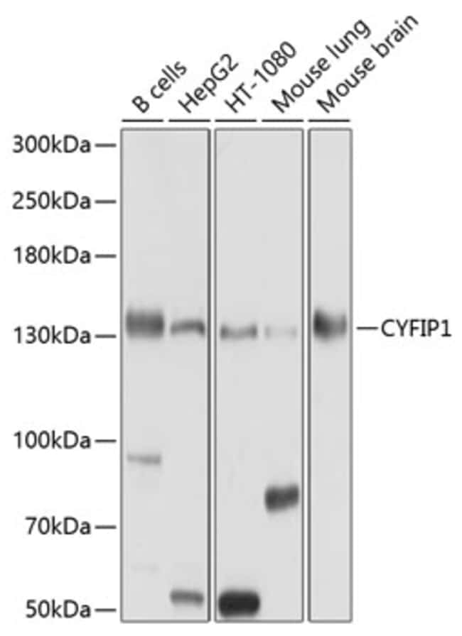 100UL CYFIP1 ANTIBODY 100 ul