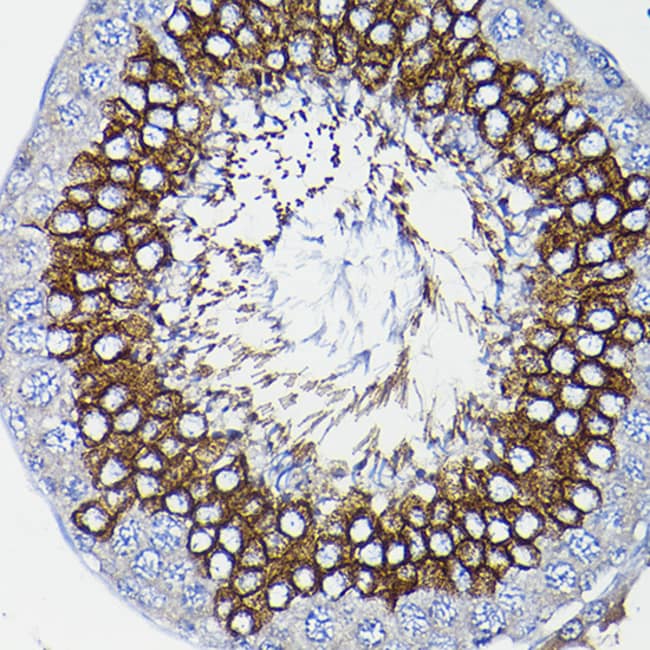 100UL ICMT ANTIBODY 100 ul