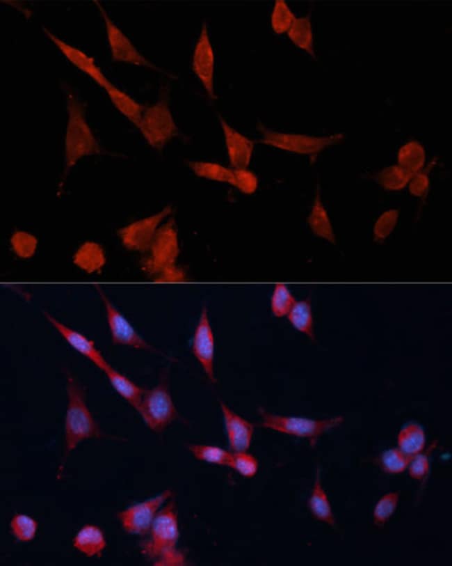 100UL DDAH1 ANTIBODY 100 ul