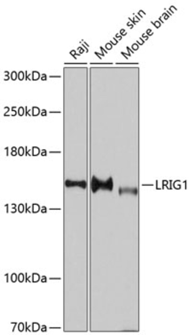 100UL LRIG1 ANTIBODY 100 ul