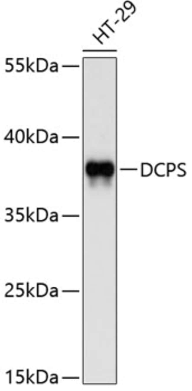 100UL DCPS ANTIBODY 100 ul