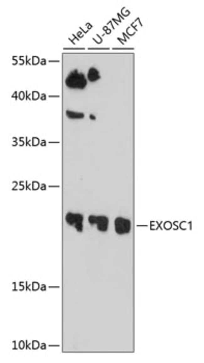 100UL EXOSC1 ANTIBODY 100 ul