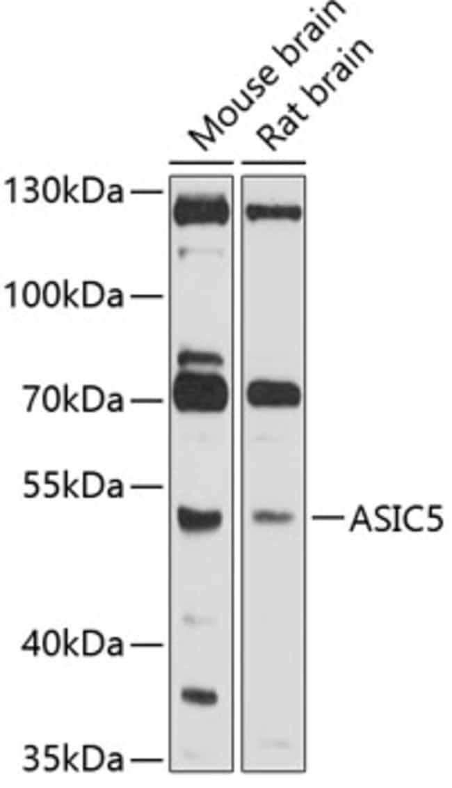 100UL ASIC5 ANTIBODY 100 ul