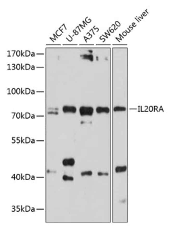 100UL IL20RA ANTIBODY 100 ul