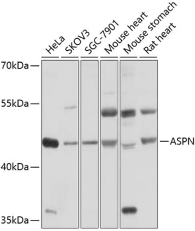 100UL ASPORIN ANTIBODY 100 ul