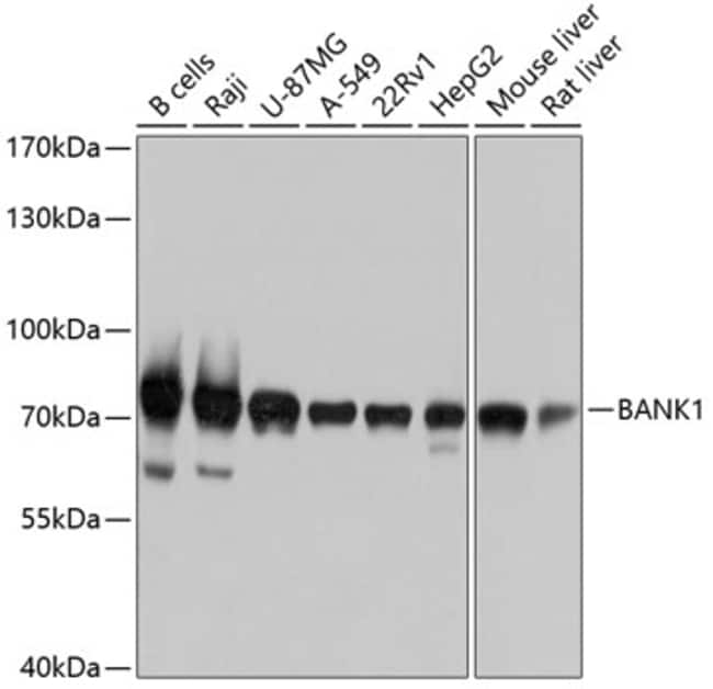 100UL BANK1 ANTIBODY 100 ul