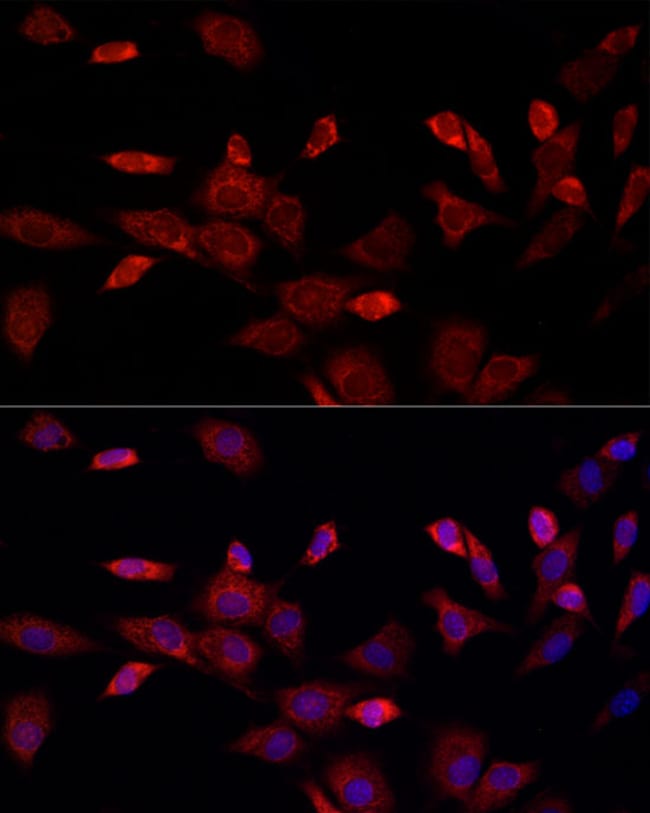 100UL CISD1 ANTIBODY 100 ul