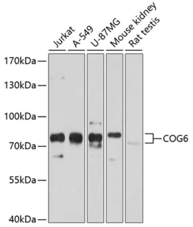 100UL COG6 ANTIBODY 100 ul