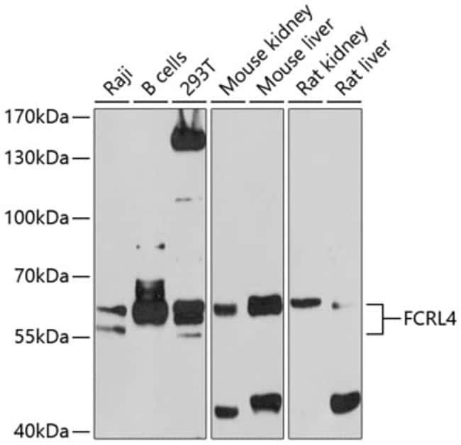 100UL FCRL4 ANTIBODY 100 ul
