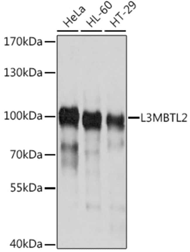 100UL L3MBTL2 ANTIBODY 100 ul