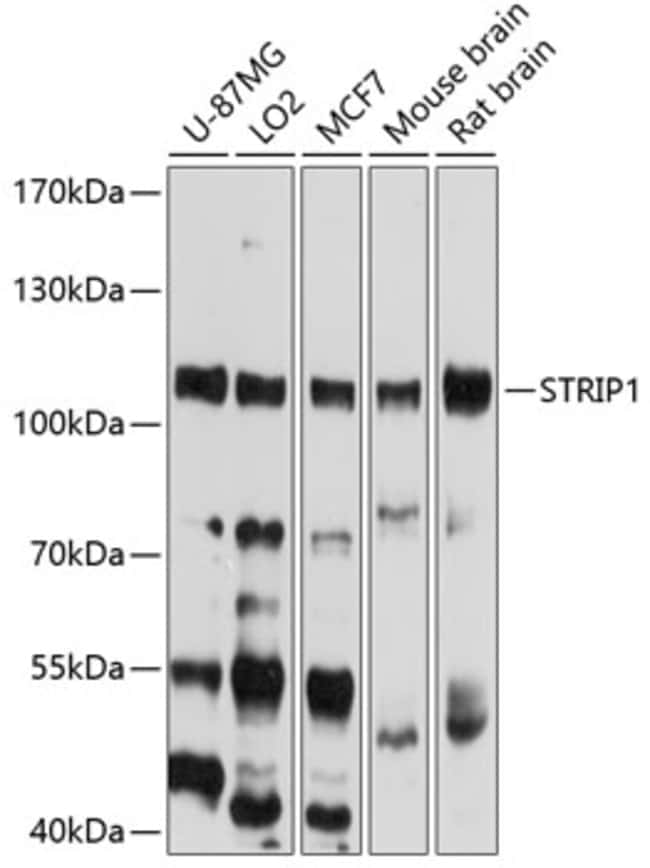 100UL FAM40A ANTIBODY 100 ul
