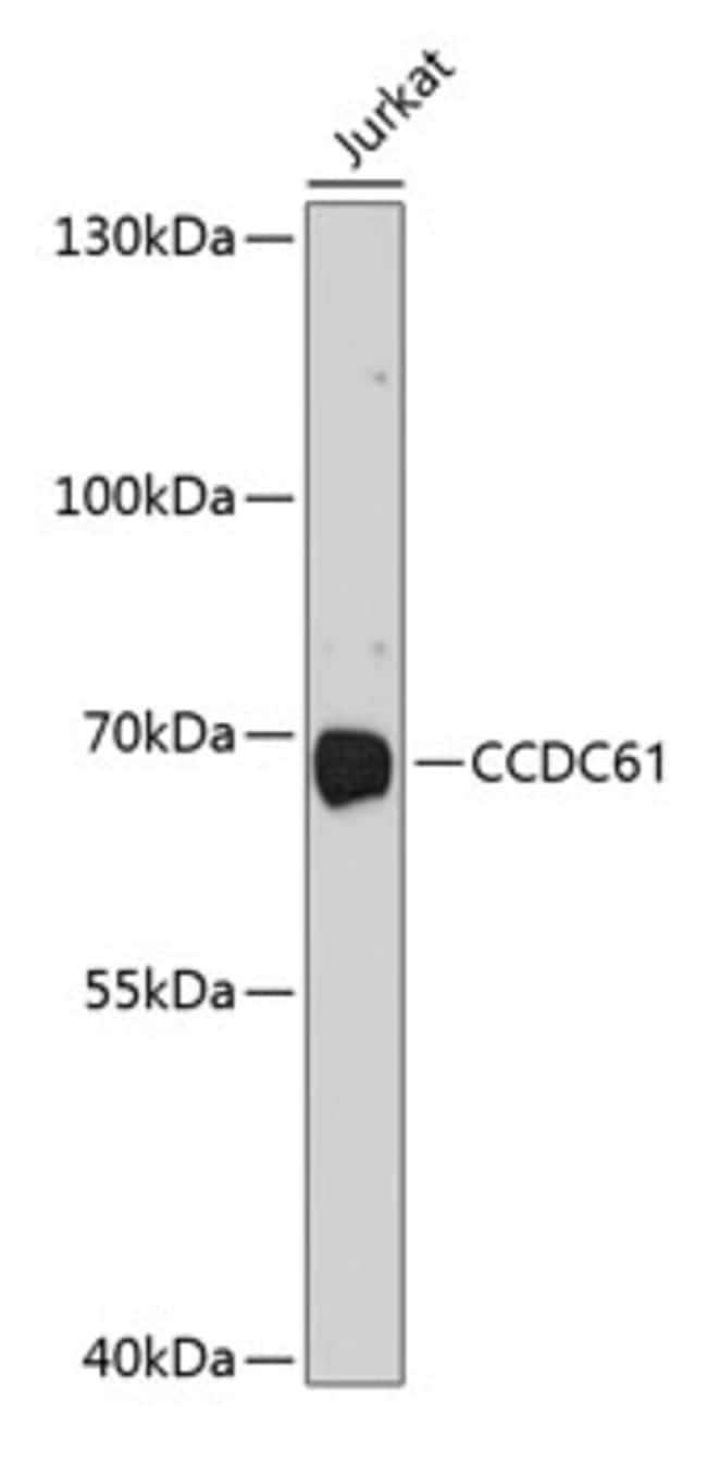 100UL CCDC61 ANTIBODY 100 ul
