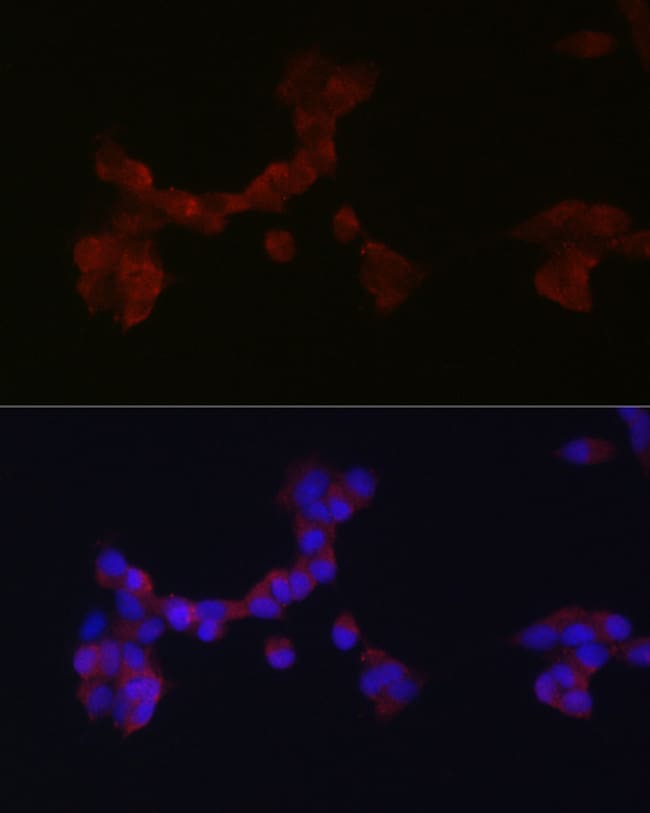 100UL DAB1 ANTIBODY 100 ul