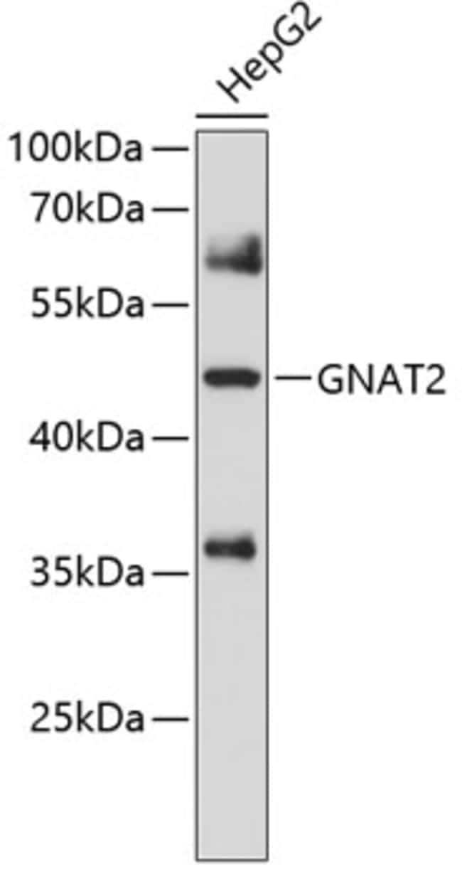 100UL GNAT2 ANTIBODY 100 ul