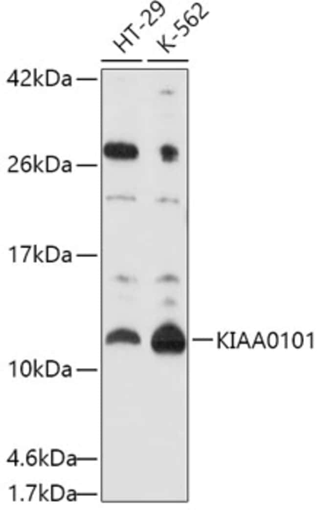 100UL KIAA0101 ANTIBODY 100 ul