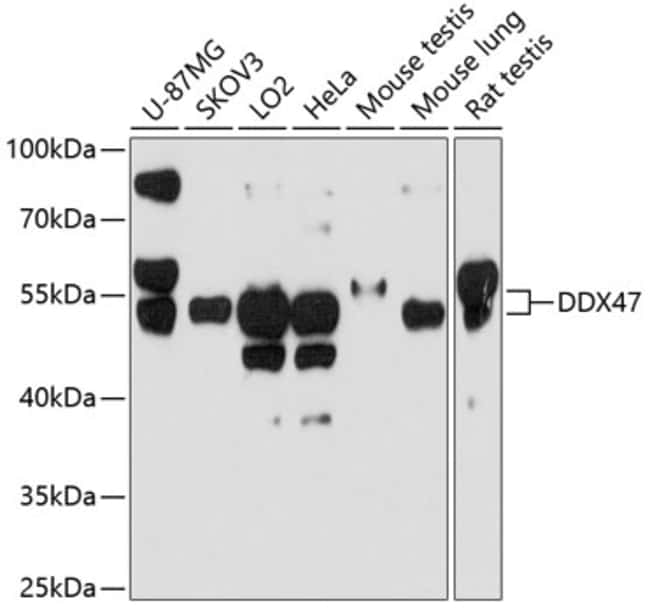 100UL DDX47 ANTIBODY 100 ul