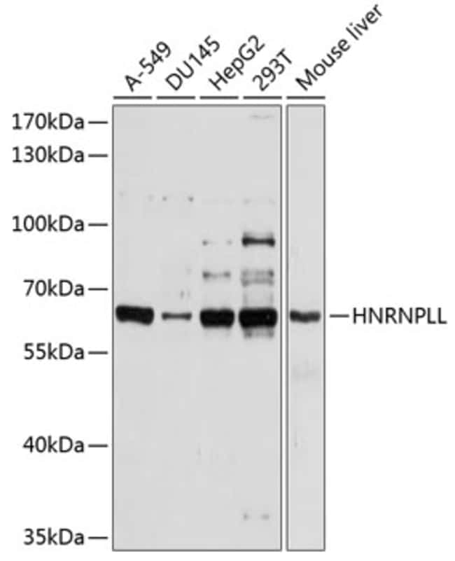 100UL HNRNP LL ANTIBODY 100 ul
