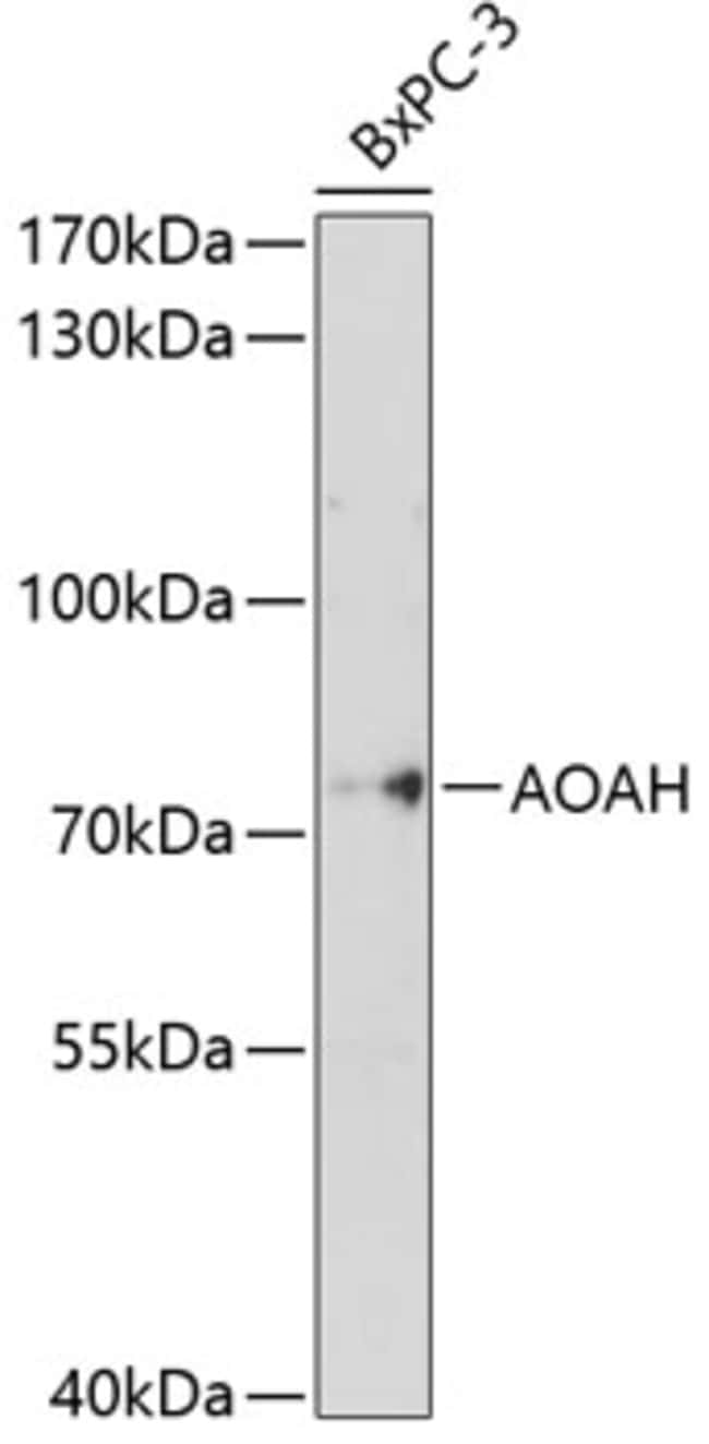 100UL AOAH ANTIBODY 100 ul