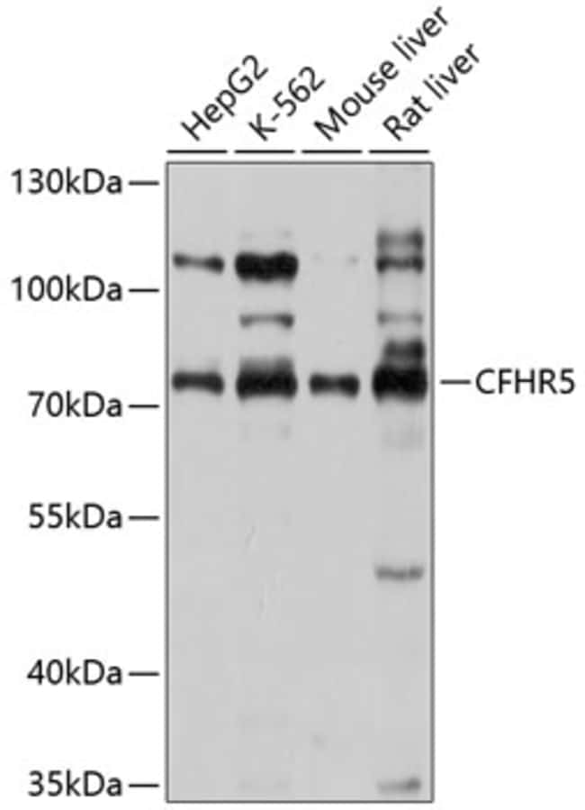 100UL CFHR5 ANTIBODY 100 ul