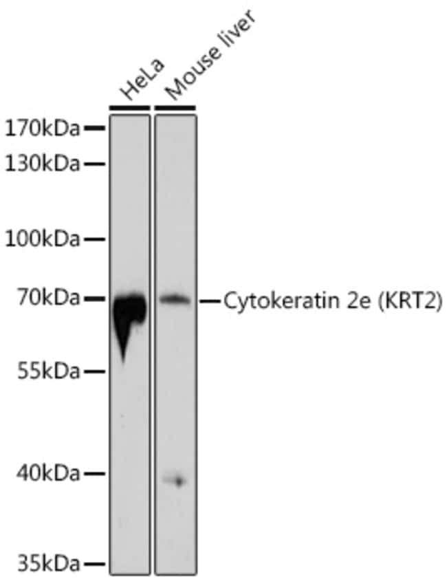100UL CYTOKERATIN 2E ANTIBODY 100 ul