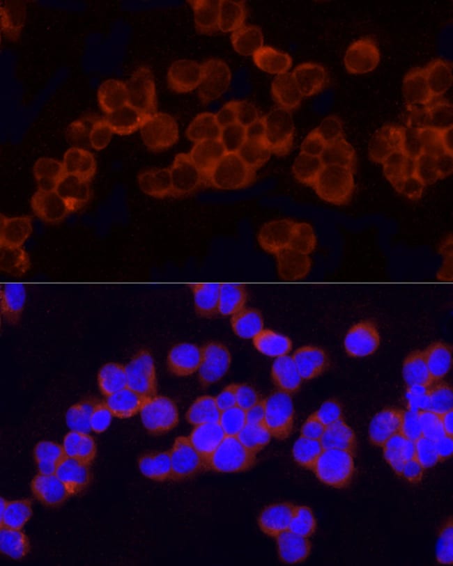100UL GCLC ANTIBODY 100 ul