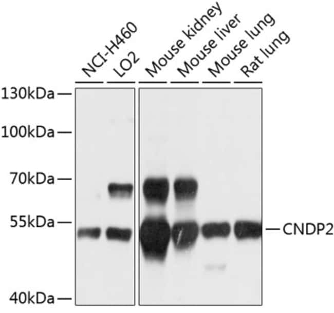 100UL CNDP2 ANTIBODY 100 ul