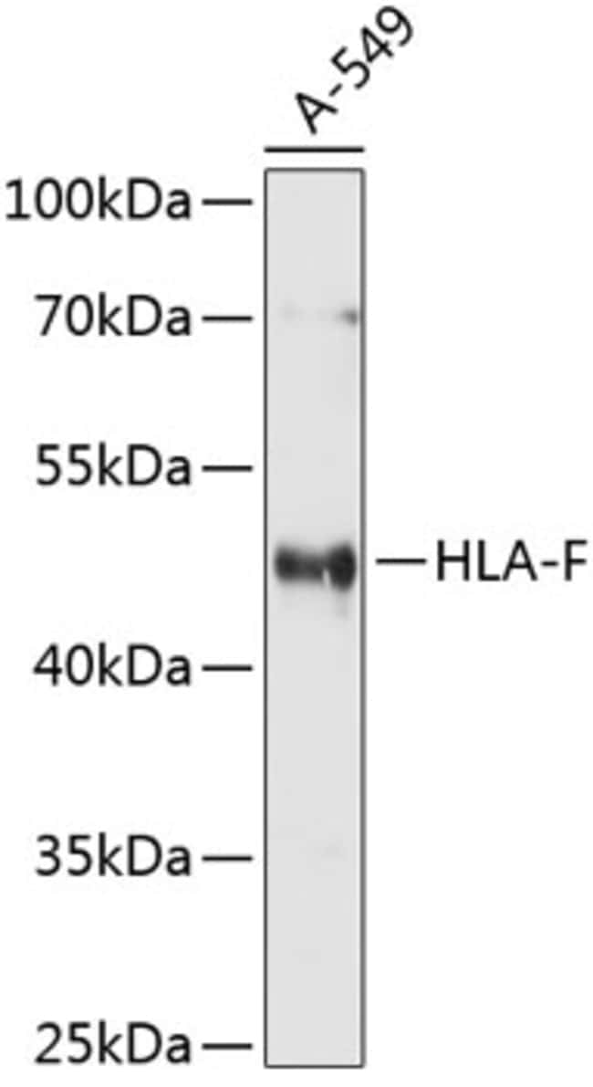 100UL HLA-F ANTIBODY 100 ul