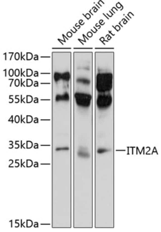 100UL ITM2A ANTIBODY 100 ul