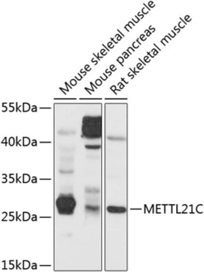 100UL METTL21C ANTIBODY 100 ul