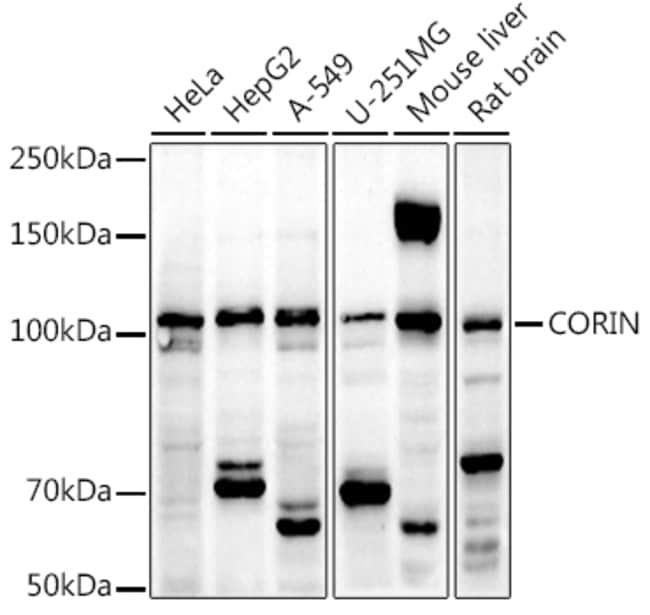 100UL CORIN ANTIBODY 100 ul