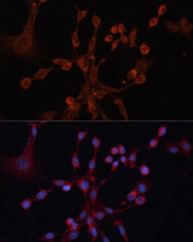 100UL GNA14 ANTIBODY 100 ul